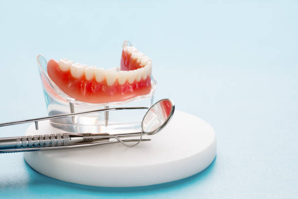 Dental Bonding in Laurel, MS